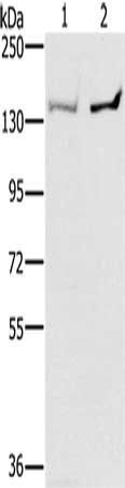 PPP2R3A Antibody