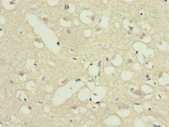 PPP2R3C Antibody