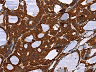 PPP2R3C Antibody