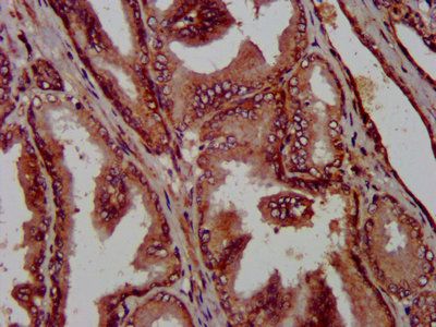 PTPA Antibody