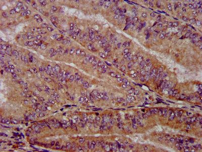 PTPA Antibody