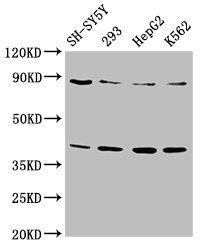 PTPA Antibody