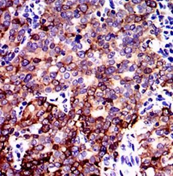 PPP2R4 Antibody