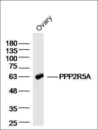 PPP2R5A antibody