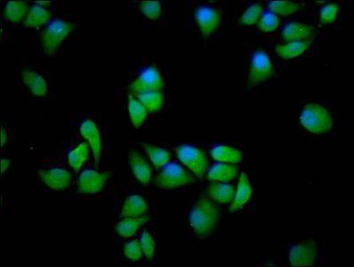 PPP2R5E Antibody