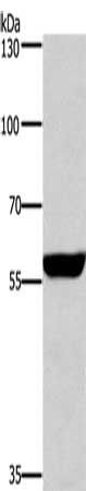 PPP3CA Antibody