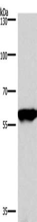 PPP3CA Antibody