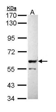 PPP3CB antibody [N1N3]