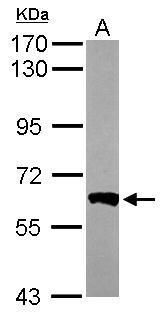 PPP3CB antibody [N1N3]