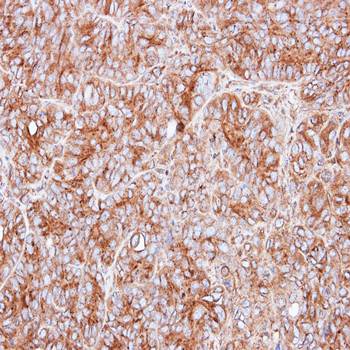 PPP3CB antibody