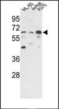 PPP3CC antibody