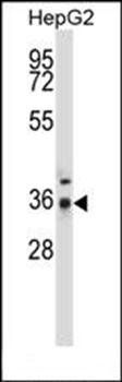 PPP4C antibody