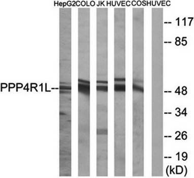 PPP4R1L Antibody