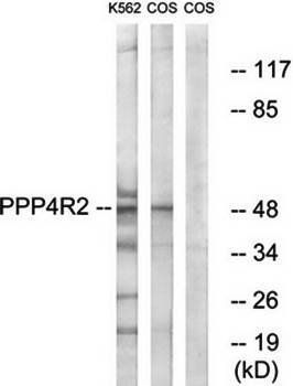 PPP4R2 Antibody