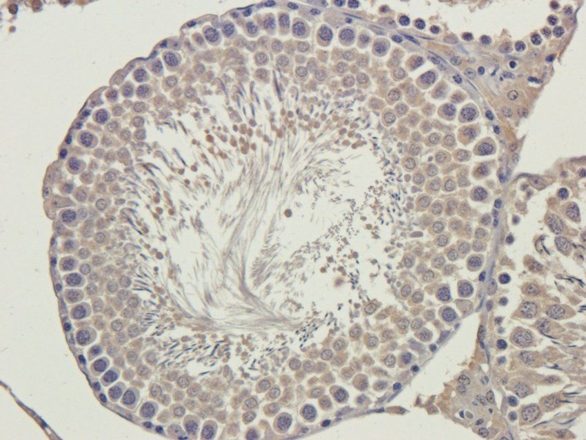 PQBP1 antibody