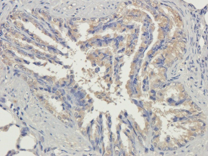 PQBP1 antibody