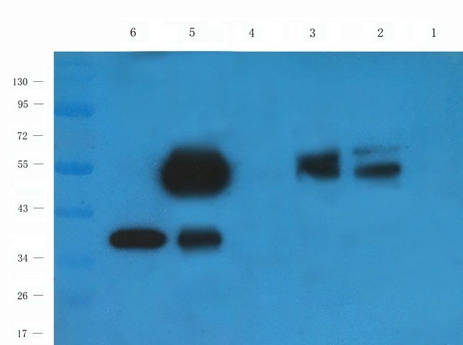 PQBP1 antibody