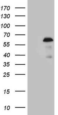 PR3 Antibody