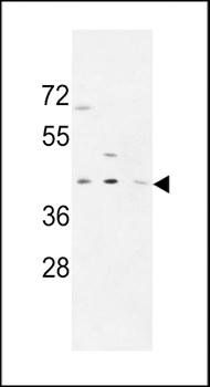 PR38A antibody