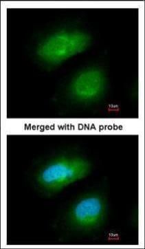 PRAK Rabbit Polyclonal Antibody