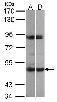 PRAK Rabbit Polyclonal Antibody
