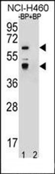 PRAMEF3 antibody