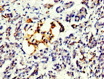 PRDM10 Antibody