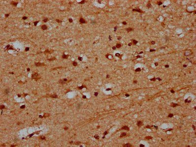 PRDM11 Antibody