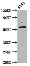 PRDM11 antibody
