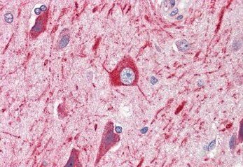 Goat anti-PRDM11 Antibody