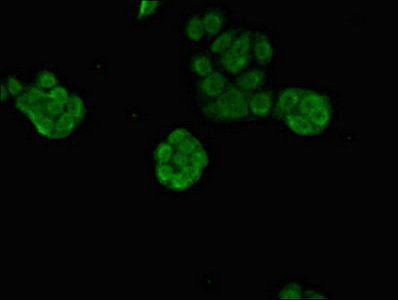 PRDM16 antibody