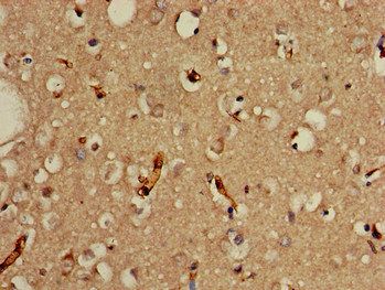 PRDM2 Antibody