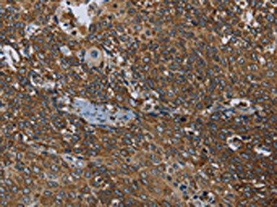 PRDM2 Antibody