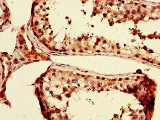 PRDM4 Antibody