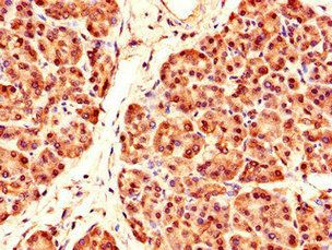 PRDM4 Antibody