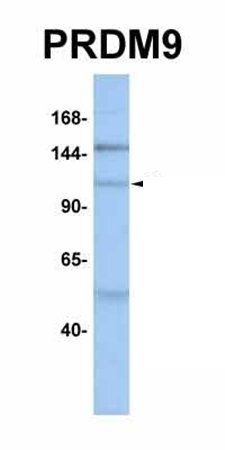 PRDM9 antibody