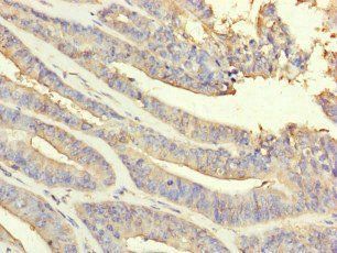 PRDX2 Antibody