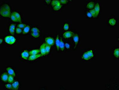 PRDX5 Antibody