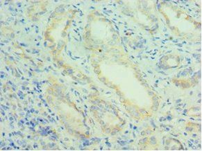 PRDX5 Antibody