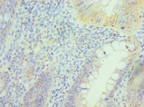 PRDX5 Antibody