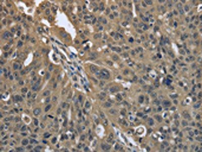 PRDX6 Antibody