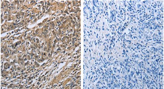 PRDX6 Rabbit Polyclonal Antibody