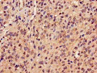 PRDX6 Antibody