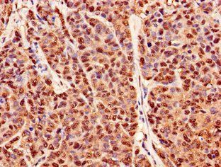 PRDX6 Antibody