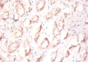 PFDN1 Antibody