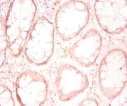 PFDN1 Antibody