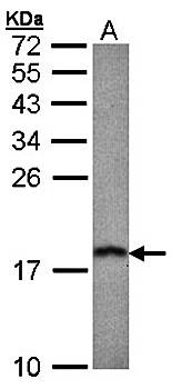 prefoldin 5 Rabbit Polyclonal Antibody