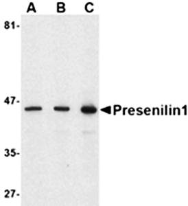 Presenilin1 Antibody
