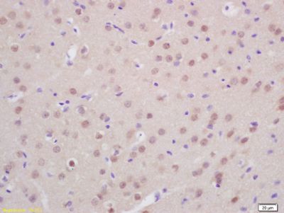Presenilin 2 Rabbit Polyclonal Antibody