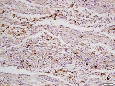 Presenilin 2 Rabbit Polyclonal Antibody